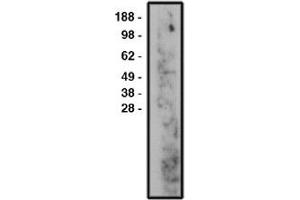 Image no. 1 for anti-Sphingomyelin Phosphodiesterase 3 (SMPD3) antibody (ABIN265269) (SMPD3 Antikörper)