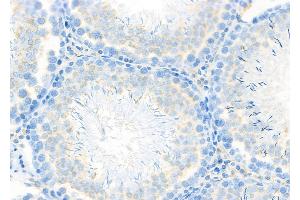 ABIN6262735 and ABIN6278108 at 1/100 staining Rat testis tissue by IHC-P. (KATNA1 Antikörper  (C-Term))