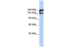 TOP2B antibody used at 0.