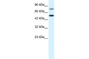 WB Suggested Anti-CHML Antibody Titration:  0. (CHML Antikörper  (N-Term))