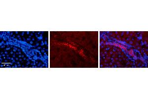 Immunohistochemistry (IHC) image for anti-Keratin 8 (KRT8) (Middle Region) antibody (ABIN2777113)