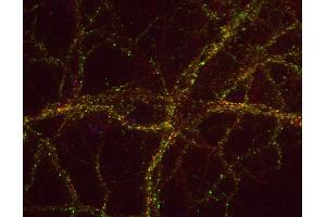 Indirect immunostaining of PFA fixed rat hippocampus neurons with anti-DAP 1 (dilution 1 : 500; green) and mouse anti-synapsin 1 (, dilution 1 : 500; green).