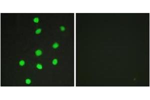 Immunofluorescence analysis of HepG2 cells, using GLI-3 Antibody.
