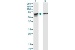 Western Blot analysis of STIP1 expression in transfected 293T cell line by STIP1 monoclonal antibody (M35), clone 2E11. (STIP1 Antikörper  (AA 1-543))