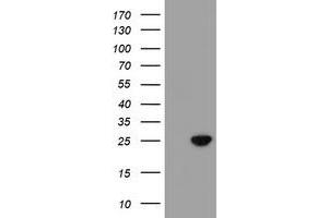 Western Blotting (WB) image for anti-Chromosome 21 Open Reading Frame 56 (C21orf56) antibody (ABIN1497041) (C21ORF56 Antikörper)