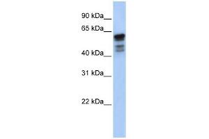 Desmin antibody used at 1 ug/ml to detect target protein. (Desmin Antikörper  (Middle Region))