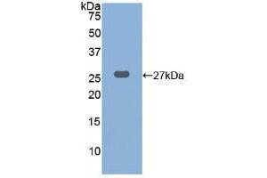 Western blot analysis of recombinant Human CTSK. (Cathepsin K Antikörper  (AA 115-329))