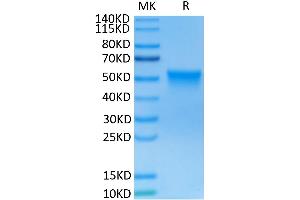 Human FGFR3 beta (IIIc) on Tris-Bis PAGE under reduced conditions.