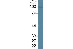 Detection of HDAC9 in Human K562 cell lysate using Polyclonal Antibody to Histone Deacetylase 9 (HDAC9) (HDAC9 Antikörper  (AA 23-343))
