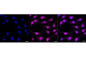 Immunocytochemical staining of HeLa cells with NFE2 antibody (ABIN7799633), 1:1,000).