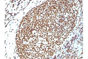 Formalin-fixed, paraffin-embedded human Tonsil stained with Histone H1 Rabbit Polyclonal Antibody.