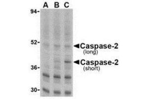 Western blot analysis of caspase-2 in Ramos cells with AP30196PU-N caspase-2 antibody at (A) 0. (Caspase 2 Antikörper  (N-Term))
