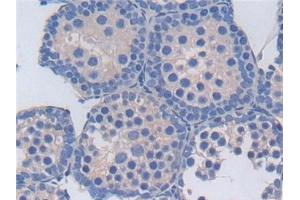 Immunohistochemistry (IHC) image for anti-Thioredoxin Interacting Protein (TXNIP) (AA 30-381) antibody (ABIN7433201)