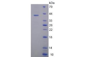 Image no. 1 for Osteocrin (OSTN) (AA 26-130) protein (His tag,GST tag) (ABIN4990704)