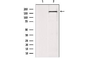 Western blot analysis of extracts from 293, using BAZ2A Antibody. (BAZ2A Antikörper  (N-Term))