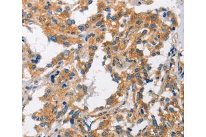 Immunohistochemistry (IHC) image for anti-Charged Multivesicular Body Protein 1A (CHMP1A) antibody (ABIN2423155)
