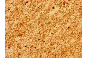 Immunohistochemistry of paraffin-embedded human brain tissue using ABIN7159593 at dilution of 1:100