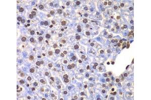Immunohistochemistry of paraffin-embedded Mouse liver using ULK4 Polyclonal Antibody at dilution of 1:100 (40x lens).