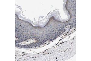 Immunohistochemical staining of human skin shows weak cytoplasmic positivity in epidermal cells. (WNT10A Antikörper)