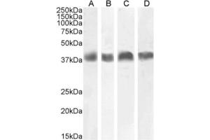 Western Blot using anti-Podoplanin (MAP tag) antibody PMab-1 (ABIN7072418) Mouse thymus (A), mouse brain (B), NIH3T3 cells (C) and mouse kidney (D) lysates (35 μg protein in RIPA buffer) were resolved on a 10 % SDS PAGE gel and blots probed with the chimeric rabbit IgG version of 1B4 (ABIN7072547) at 0.