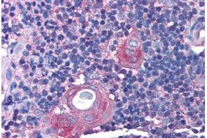 Immunohistochemistry (Paraffin-embedded Sections) (IHC (p)) image for anti-RAB14, Member RAS Oncogene Family (RAB14) (C-Term) antibody (ABIN6736424)
