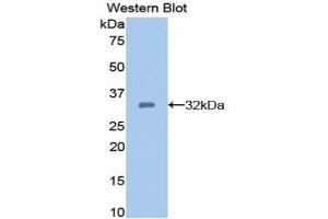 Western Blotting (WB) image for anti-Dickkopf Homolog 1 (DKK1) (AA 33-266) antibody (ABIN3207969) (DKK1 Antikörper  (AA 33-266))