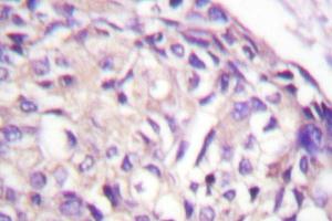 Immunohistochemistry analysis with AurA (pPro282) antibody on paraffin sections. (Aurora A Antikörper)