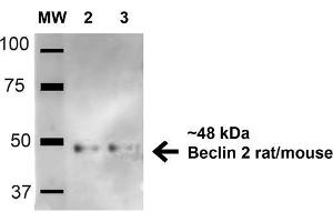 Western blot analysis of Human HeLa and 293Trap cell lysates showing detection of 48. (Beclin 2 Antikörper  (AA 410-421) (Atto 594))