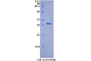 SDS-PAGE analysis of Human ADAM9 Protein. (ADAM9 Protein)