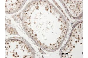Immunoperoxidase of monoclonal antibody to USP29 on formalin-fixed paraffin-embedded human testis. (USP29 Antikörper  (AA 131-240))