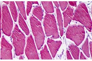 Anti-CAMK1D antibody IHC staining of human skeletal muscle. (CAMK1D Antikörper  (AA 1-96))