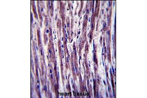 PTPLA Antibody (N-term) (ABIN657409 and ABIN2846449) immunohistochemistry analysis in formalin fixed and paraffin embedded human heart tissue followed by peroxidase conjugation of the secondary antibody and DAB staining.