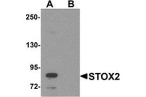 Western blot analysis of STOX2 in human kidney tissue lysate with STOX2 antibody at 1 μg/ml in (A) the absence and (B) the presence of blocking peptide. (STOX2 Antikörper  (C-Term))
