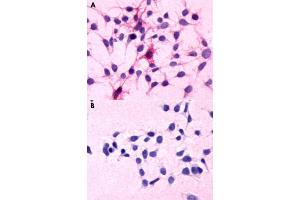 Immunocytochemical staining of HEK293 human embryonic kidney cells transfected (A) and untranfected (B) with C5AR1. (C5AR1 Antikörper  (N-Term))