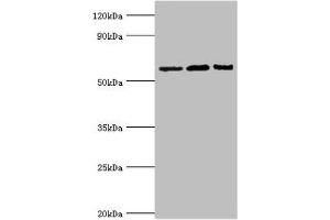 Western blot All lanes: Interleukin-10 receptor subunit alpha antibody at 8 μg/mL Lane 1: Mouse heart tissue Lane 2: Hela whole cell lysate Lane 3: Mouse liver tissue Secondary Goat polyclonal to rabbit IgG at 1/10000 dilution Predicted band size: 63 kDa Observed band size: 63 kDa (IL1RN Antikörper  (AA 22-230))