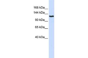 WB Suggested Anti-IGSF1 Antibody Titration:  0. (IGSF1 Antikörper  (N-Term))