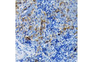 Immunohistochemistry of paraffin-embedded mouse spleen using TNFR1/TNFRSF1A Rabbit pAb (ABIN3022103, ABIN3022104, ABIN1513619 and ABIN6218606) at dilution of 1:100 (40x lens).