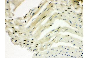 Anti- SLUG Picoband antibody,IHC(P) IHC(P): Mouse Cardiac Muscle Tissue (SLUG Antikörper  (Middle Region))