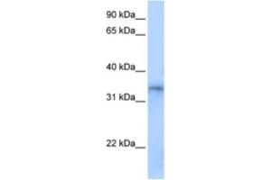 Western Blotting (WB) image for anti-Four and A Half LIM Domains 5 (FHL5) antibody (ABIN2463444) (FHL5 Antikörper)