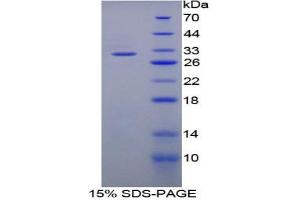SDS-PAGE analysis of Rat Matrix Metalloproteinase 8 (MMP8) Protein.