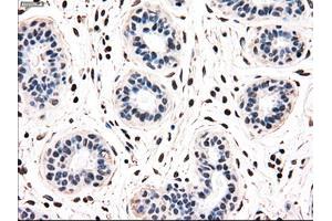 Immunohistochemical staining of paraffin-embedded breast tissue using anti-NRBP1 mouse monoclonal antibody. (NRBP1 Antikörper)