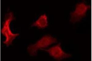 ABIN6275017 staining RAW264. (Claudin 6 Antikörper  (Internal Region))