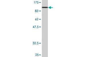 Western Blot detection against Immunogen (97. (FUBP1 Antikörper  (AA 1-653))