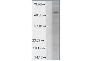 Western blot analysis of GABA(A)R Alpha1 a in a human cell line mix using a 1/1000 dilution of AM20084PU (GABRA1 Antikörper  (AA 327-450, AA 355-394))