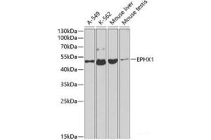 Western blot analysis of extracts of various cell lines using EPHX1 Polyclonal Antibody at dilution of 1:1000. (EPHX1 Antikörper)