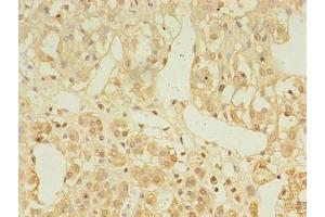Immunohistochemistry of paraffin-embedded human adrenal gland tissue using ABIN7158414 at dilution of 1:100 (LDAH/C2orf43 Antikörper  (AA 1-325))