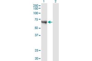 Western Blot analysis of CAMKK1 expression in transfected 293T cell line by CAMKK1 monoclonal antibody (M02), clone 4B4. (CAMKK1 Antikörper  (AA 2-100))