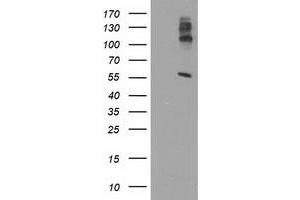 Western Blotting (WB) image for anti-Lipase, Endothelial (LIPG) antibody (ABIN1499172) (LIPG Antikörper)