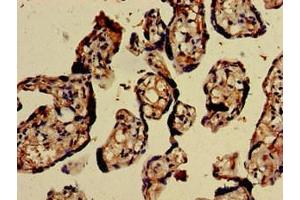 Immunohistochemistry of paraffin-embedded human placenta tissue using ABIN7147724 at dilution of 1:100 (CHD5 Antikörper  (AA 1600-1699))