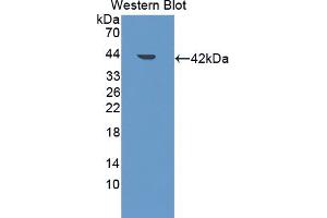 Western blot analysis of the recombinant protein. (LDLRAP1 Antikörper  (AA 1-308))